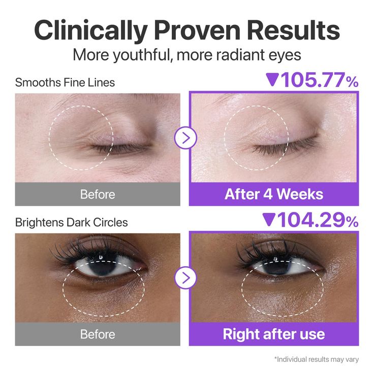 Numbuzin No.9 NAD+ Retinol Volumetox Eye Cream 10ml – Anti-Aging Eye Care Solution